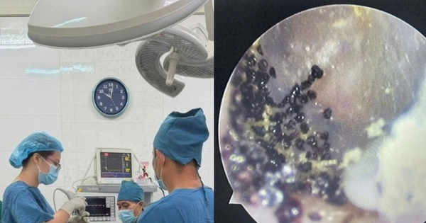 Hình ảnh từ tai em bé 7 tuổi ở Khánh Hoà khiến nhiều cha mẹ "nổi da gà": Nuôi con không thể lơ là điều này được! - Kenh14.vn